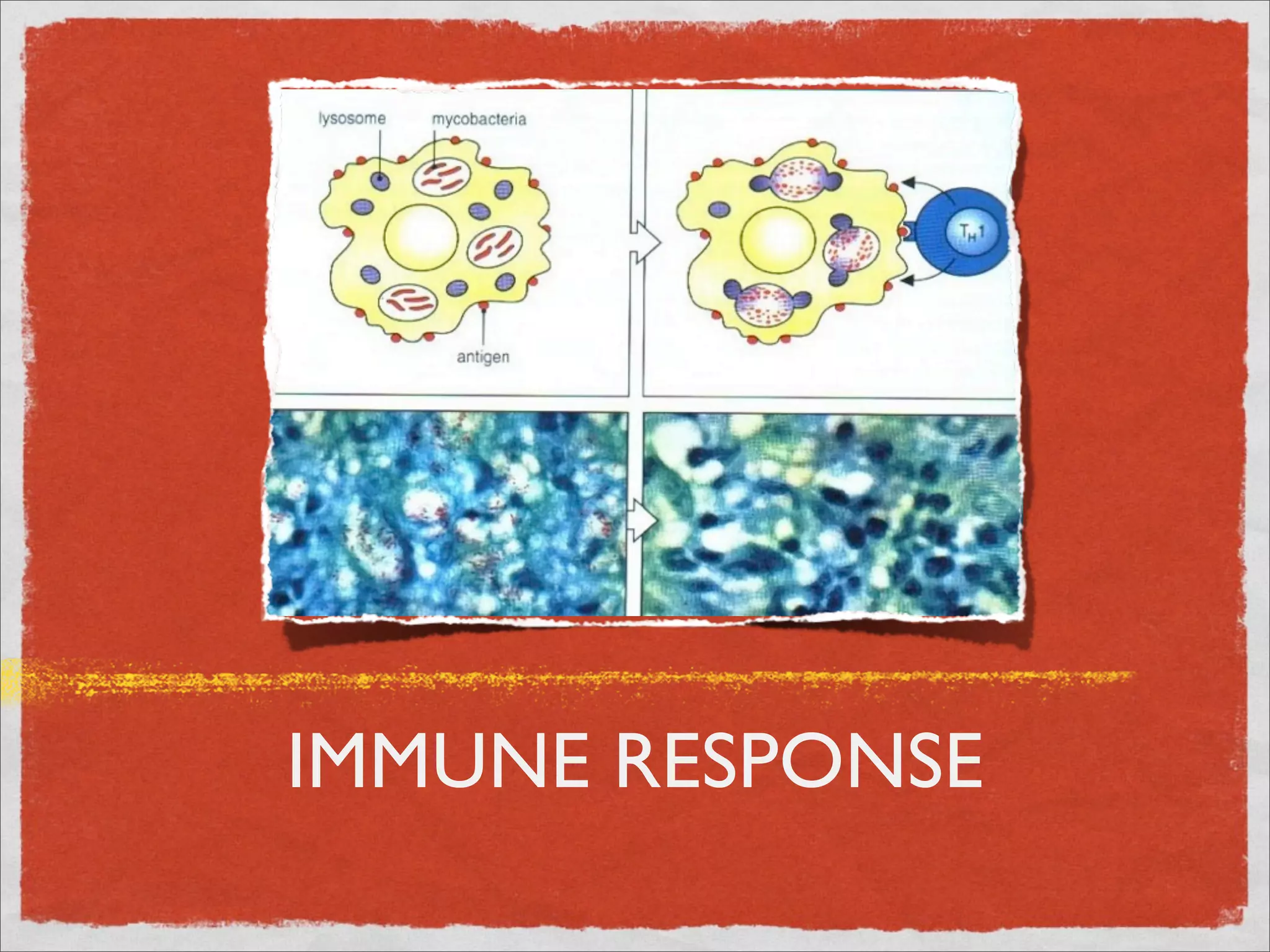 IMMUNE RESPONSE
 
