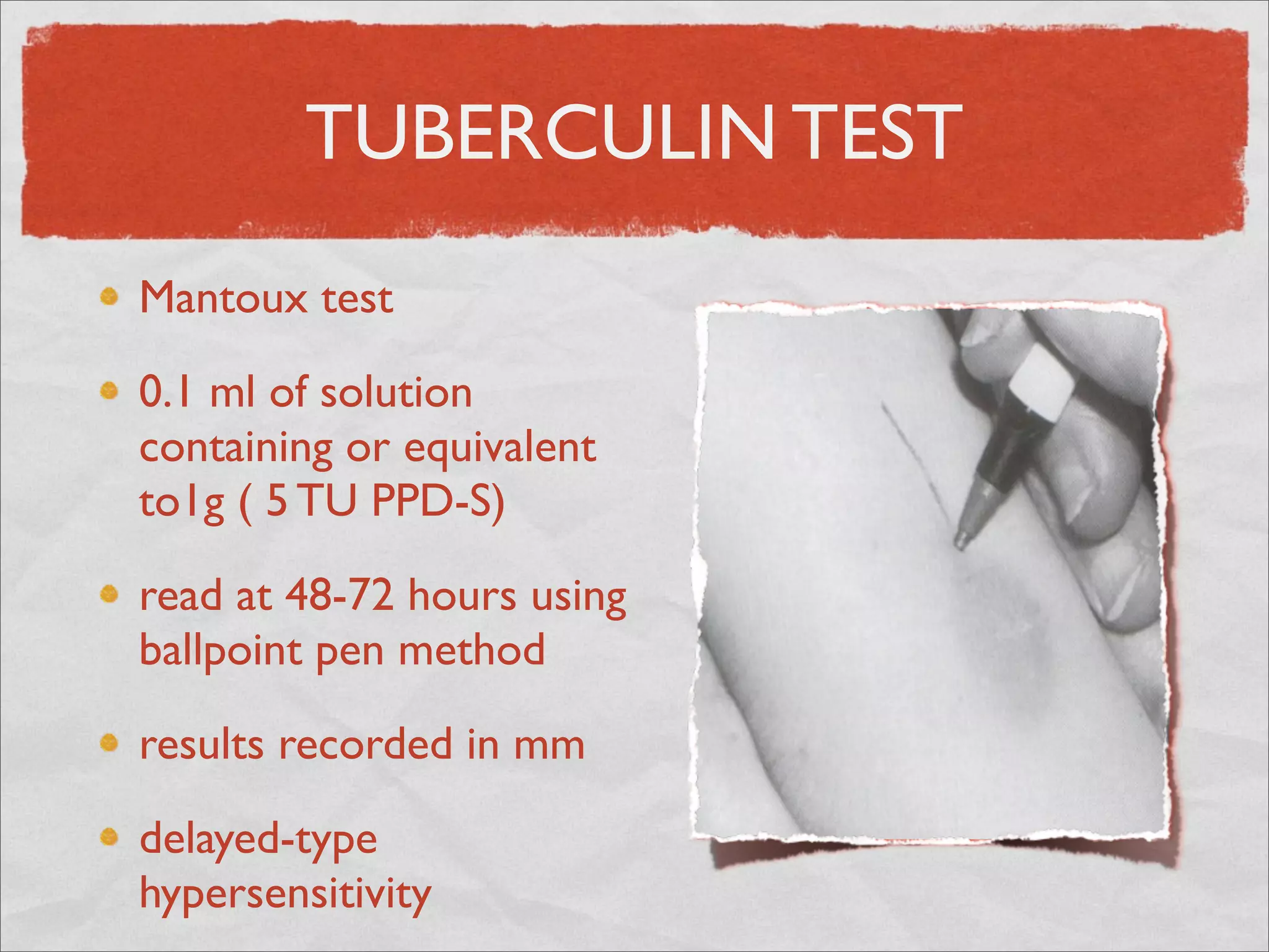 TUBERCULIN TEST
Mantoux test

0.1 ml of solution
containing or equivalent
to1g ( 5 TU PPD-S)

read at 48-72 hours using
ballpoint pen method

results recorded in mm

delayed-type
hypersensitivity
 