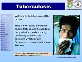 Introduction
       1




                        Tuberculosis                                          Partners in Global Health Education




w to use this module
                       Welcome to the tuberculosis (TB)
arning outcomes
at is TB?              module.
demiology
 robiology
nsmission              TB is a major cause of morbidity
ction 1 quiz
ural history
                       and mortality all over the world but
ction 2 quiz           the greatest burden is borne by
mptoms and signs
ction 3 quiz
                       developing countries. The
gnosis                 bacterium Mycobacterium
atment
vention and control    tuberculosis is responsible for most
ction 4 quiz
ormation sources
                       TB cases.
mmative assessment


                       For more information about the authors and
                       reviewers of this module, click here
                                                                    IUATLD; WHO/TBP/Falise
 
