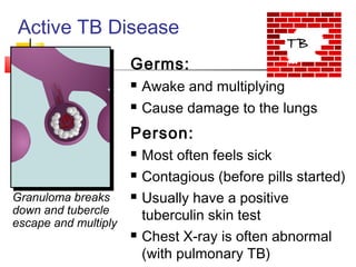 Active TB Disease
Germs:
 Awake and multiplying
 Cause damage to the lungs
Person:
 Most often feels sick
 Contagious (before pills started)
 Usually have a positive
tuberculin skin test
 Chest X-ray is often abnormal
(with pulmonary TB)
Granuloma breaks
down and tubercle
escape and multiply
TB
 