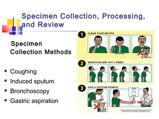 Specimen
Collection Methods
 Coughing
 Induced sputum
 Bronchoscopy
 Gastric aspiration
Specimen Collection, Processing,
and Review
 