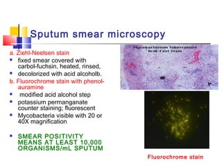 Sputum smear microscopy
a. Ziehl-Neelsen stain
 fixed smear covered with
carbol-fuchsin, heated, rinsed,
 decolorized with acid alcoholb.
b. Fluorochrome stain with phenol-
auramine
 modified acid alcohol step
 potassium permanganate
counter staining; fluorescent
 Mycobacteria visible with 20 or
40X magnification
 SMEAR POSITIVITY
MEANS AT LEAST 10,000
ORGANISMS/mL SPUTUM
Fluorochrome stain
 