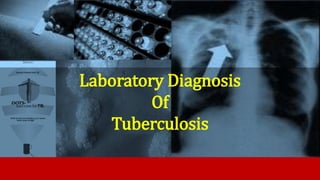 Laboratory Diagnosis
Of
Tuberculosis
Tarun Prudvi B
MBBS 3RD PROFESSSIONAL
 