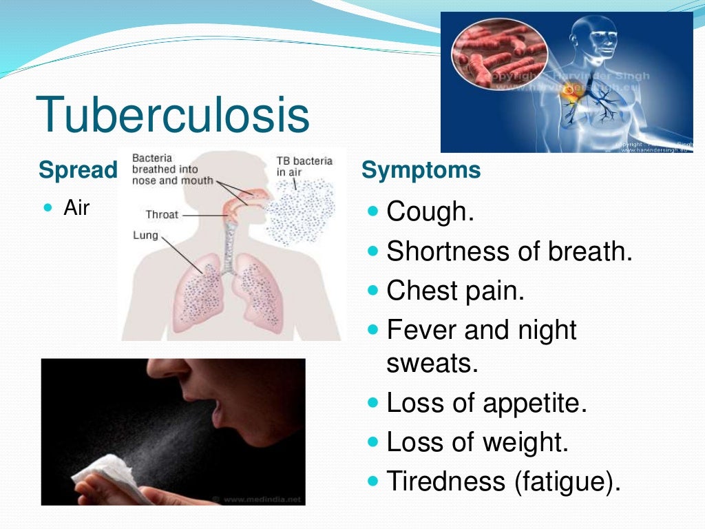 tuberculosis presentation pdf