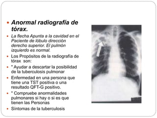  Anormal radiografía de
tórax.
 La flecha Apunta a la cavidad en el
Paciente de lóbulo dirección
derecho superior. El pulmón
izquierdo es normal.
 Los Propósitos de la radiografía de
tórax son:
 " Ayudar a descartar la posibilidad
de la tuberculosis pulmonar
 Enfermedad en una persona que
tiene una TST positiva o una
resultado QFT-G positivo.
 " Compruebe anormalidades
pulmonares si hay o si es que
tienen las Personas
 Síntomas de la tuberculosis
 