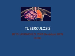 TUBERCULOSIS
BY Dr.AVINASH.D DNB Resident GEN
SURG
 