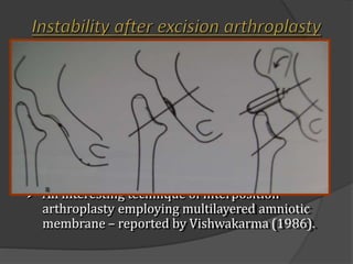 Tuberculosis | PPTX