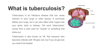 What is tuberculosis?
Tuberculosis is an infectious disease that can cause
infection in your lungs or other tissues. It commonly
affects your lungs, but it can also affect other organs like
your spine, brain or kidneys. The word “tuberculosis”
comes from a Latin word for "nodule" or something that
sticks out.
Tuberculosis is also known as TB. Not everyone who
becomes infected with TB gets sick, but if you do get sick
you need to be treated.
 