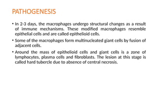 PATHOGENESIS
• In 2-3 days, the macrophages undergo structural changes as a result
of immune mechanisms. These modified macrophages resemble
epithelial cells and are called epithelioid cells.
• Some of the macrophages form multinucleated giant cells by fusion of
adjacent cells.
• Around the mass of epithelioid cells and giant cells is a zone of
lymphocytes, plasma cells and fibroblasts. The lesion at this stage is
called hard tubercle due to absence of central necrosis.
 