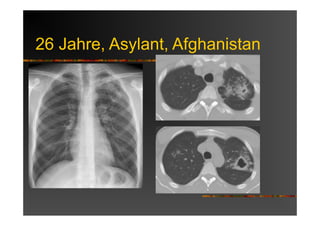 26 Jahre, Asylant, Afghanistan
 