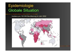 Epidemiologie
Globale Situation
Inzidenz pro 100 000 Bevölkerung im Jahr 2002
 