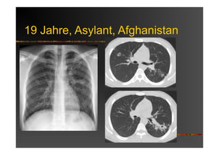 19 Jahre, Asylant, Afghanistan
 
