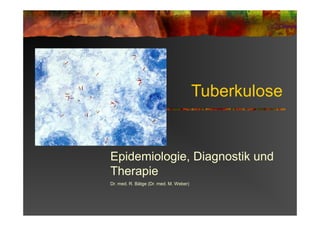 Tuberkulose
Epidemiologie, Diagnostik und
Therapie
Dr. med. R. Bätge (Dr. med. M. Weber)
 