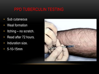 Pharmacotherapy of TUBERCULOSIS | PPTX