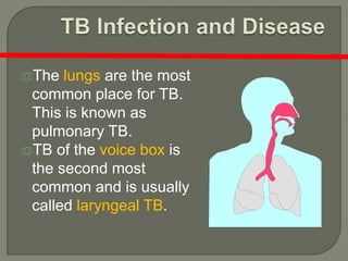 The lungs are the most
common place for TB.
This is known as
pulmonary TB.
TB of the voice box is
the second most
common and is usually
called laryngeal TB.
 