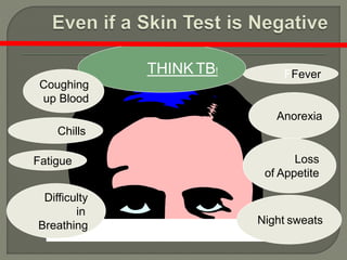 Chiclls
FFeverTHINK TB!
Chills
Fatigue
Difficulty
in
Breathing
Anorexia
Loss
of Appetite
Night sweats
Coughing
up Blood
 
