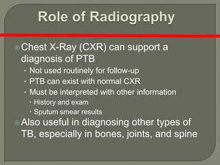 Chest X-Ray (CXR) can support a
diagnosis of PTB
• Not used routinely for follow-up
• PTB can exist with normal CXR
• Must be interpreted with other information
 History and exam
 Sputum smear results
Also useful in diagnosing other types of
TB, especially in bones, joints, and spine
 