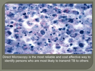 Direct Microscopy is the most reliable and cost effective way to
identify persons who are most likely to transmit TB to others
© ITECH, 2006 © University of Alabama at Birmingham, Department of Pathology
 