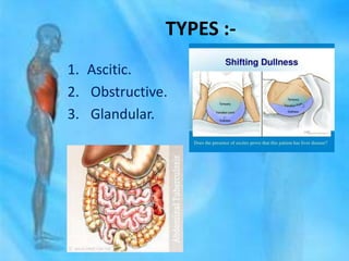 TYPES :-
1. Ascitic.
2. Obstructive.
3. Glandular.
 