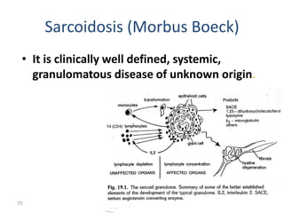 Sarcoidosis (Morbus Boeck)
• It is clinically well defined, systemic,
granulomatous disease of unknown origin.
•
Histology
•
Altered immune
response
75 75
 
