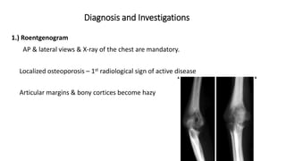 TB Basics of ATT.pdf