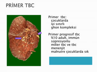 Primer tbc:
  çocuklarda
  iyi sınırlı
  ghon kompleksi

Primer progresif tbc
  %10 adult, immün
  süpresyonlu
  milier tbc ve tbc
  menenjit
  malnutre çocuklarda sık
 