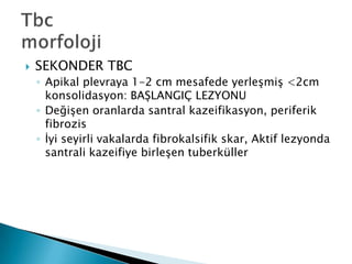    SEKONDER TBC
    ◦ Apikal plevraya 1-2 cm mesafede yerleĢmiĢ <2cm
      konsolidasyon: BAġLANGIÇ LEZYONU
    ◦ DeğiĢen oranlarda santral kazeifikasyon, periferik
      fibrozis
    ◦ Ġyi seyirli vakalarda fibrokalsifik skar, Aktif lezyonda
      santrali kazeifiye birleĢen tuberküller
 