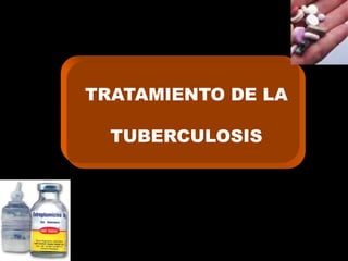 TRATAMIENTO DE LA

  TUBERCULOSIS
 