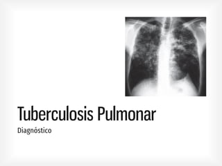Tuberculosis Pulmonar