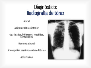 Diagnóstico:
Radiografía de tórax