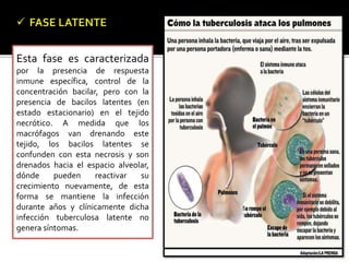 Esta fase es caracterizada
por la presencia de respuesta
inmune específica, control de la
concentración bacilar, pero con la
presencia de bacilos latentes (en
estado estacionario) en el tejido
necrótico. A medida que los
macrófagos van drenando este
tejido, los bacilos latentes se
confunden con esta necrosis y son
drenados hacia el espacio alveolar,
dónde pueden reactivar su
crecimiento nuevamente, de esta
forma se mantiene la infección
durante años y clínicamente dicha
infección tuberculosa latente no
genera síntomas.
 