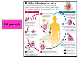 Fisiopatología
 