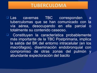 Las cavernas TBC corresponden a tuberculomas que se han comunicado con la vía aérea, desocupando en ella parcial o totalmente su contenido caseoso. Constituyen la característica probablemente más importante de la TBC Postprimaria, implica la salida del BK del entorno intracelular (en los macrófagos), diseminación endobronquial con compromiso de otras zonas del pulmón y abundante expectoración del bacilo 