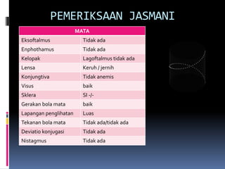 PEMERIKSAAN JASMANI
MATA
Eksoftalmus Tidak ada
Enphothamus Tidak ada
Kelopak Lagoftalmus tidak ada
Lensa Keruh / jernih
Konjungtiva Tidak anemis
Visus baik
Sklera SI -/-
Gerakan bola mata baik
Lapangan penglihatan Luas
Tekanan bola mata Tidak ada/tidak ada
Deviatio konjugasi Tidak ada
Nistagmus Tidak ada
 