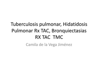 Tuberculosis pulmonar, Hidatidosis
Pulmonar Rx TAC, Bronquiectasias
RX TAC TMC
Camila de la Vega Jiménez
 