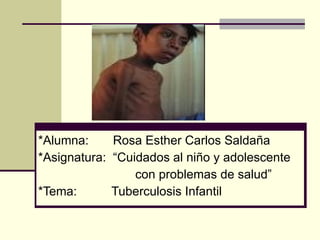 *Alumna:     Rosa Esther Carlos Saldaña
*Asignatura: “Cuidados al niño y adolescente
                 con problemas de salud”
*Tema:       Tuberculosis Infantil
 