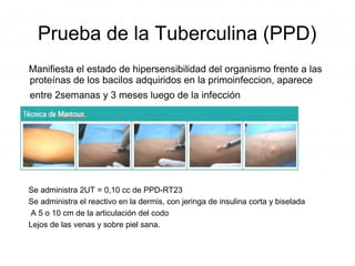 Prueba de la Tuberculina (PPD)
Manifiesta el estado de hipersensibilidad del organismo frente a las
proteínas de los bacilos adquiridos en la primoinfeccion, aparece
entre 2semanas y 3 meses luego de la infección
Se administra 2UT = 0,10 cc de PPD-RT23
Se administra el reactivo en la dermis, con jeringa de insulina corta y biselada
A 5 o 10 cm de la articulación del codo
Lejos de las venas y sobre piel sana.
 