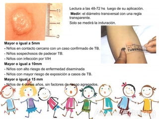 Lectura a las 48-72 hs luego de su aplicación.
Medir: el diámetro transversal con una regla
transparente.
Solo se medirá la induración.
Mayor o igual a 5mm
- Niños en contacto cercano con un caso confirmado de TB.
- Niños sospechosos de padecer TB.
- Niños con infección por VIH
Mayor o igual a 10mm
- Niños con alto riesgo de enfermedad diseminada
- Niños con mayor riesgo de exposición a casos de TB.
Mayor o igual a 15 mm
- Niños de 4 o mas años, sin factores de riesgo agregados.
 