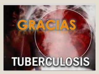 tuberculosis