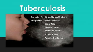 Tuberculosis
Docente: Dra. María Blanca Machuca
Integrantes: Nicole Benavente
Oscar Arce
Wallison Castro
Fernanda Freitas
Carlos Ruilowa
Adryelle Dos Santos
 