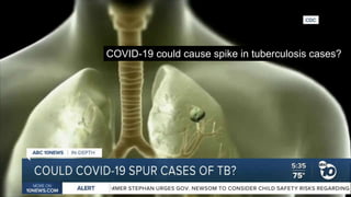 COVID-19 could cause spike in tuberculosis cases?
 