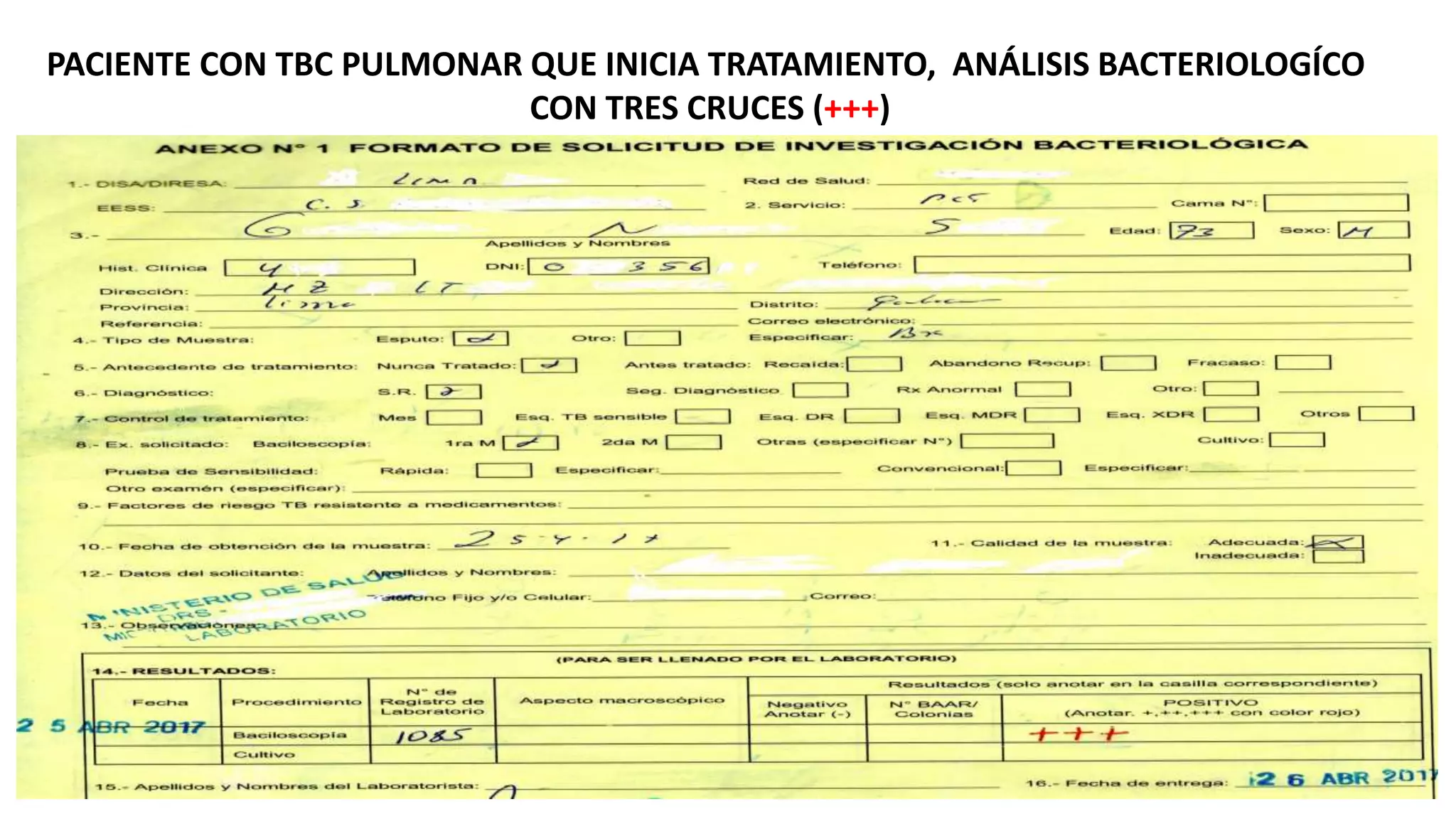 PACIENTE CON TBC PULMONAR QUE INICIA TRATAMIENTO, ANÁLISIS BACTERIOLOGÍCO
CON TRES CRUCES (+++)