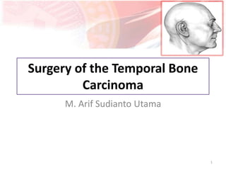 Surgery of the Temporal Bone
Carcinoma
1
M. Arif Sudianto Utama
 