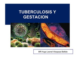 TUBERCULOSIS Y
GESTACION
MR Hugo Leonel Vilcapaza Bellido
 