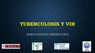 TUBERCULOSIS Y VIH
MARCO ANTONIO CORNEJO CRUZ
 