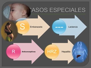 CASOS ESPECIALES
