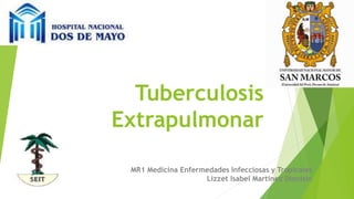 Tuberculosis
Extrapulmonar
MR1 Medicina Enfermedades Infecciosas y Tropicales
Lizzet Isabel Martinez Dionisio
 