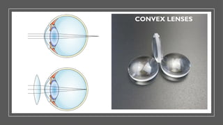 CONVEX LENSES
 