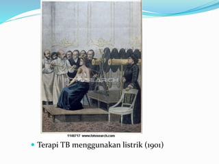  Terapi TB menggunakan listrik (1901)
 