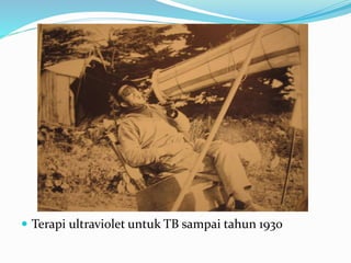  Terapi ultraviolet untuk TB sampai tahun 1930
 